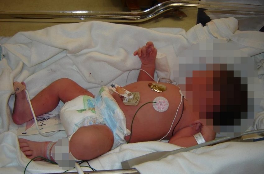  Cerca de 40 minutos depois de ser declarada morta, bebê volta à vida no HU em Cascavel