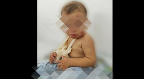  Criança é socorrida em estado grave com sinais de tortura em Prudentópolis. Mãe foi presa