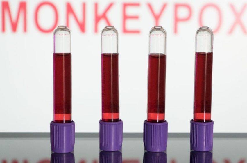  Laboratório passa a fazer teste para diagnóstico da Monkeypox no Paraná e outros estados do Sul