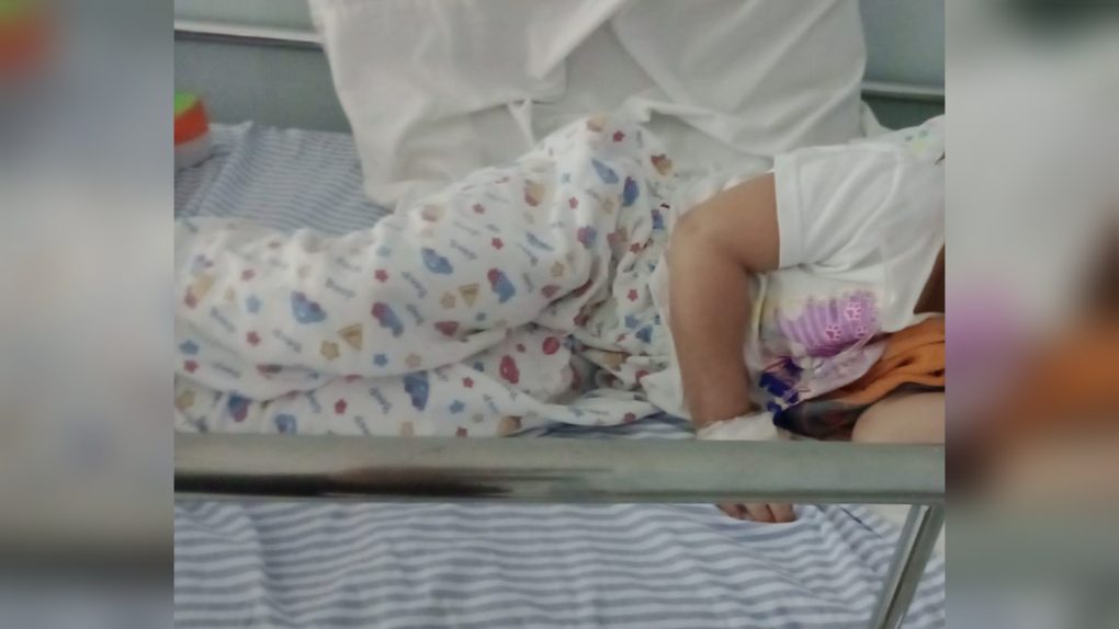  Criança atropelada em São Mateus do Sul recebe alta: “Milagre”, diz mãe