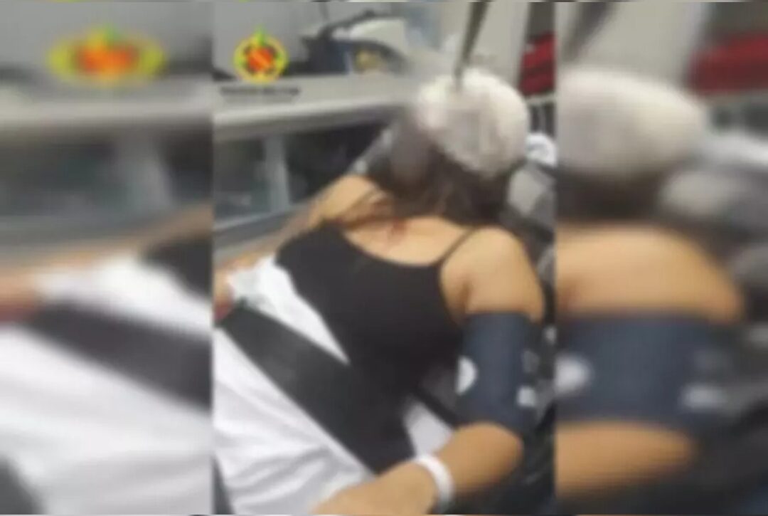  Imagem forte: mulher fica com faca cravada na cabeça após briga com namorado