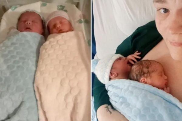  Gêmeos simultâneos: bebês nascem ao mesmo tempo em parto considerado “ultra” raro